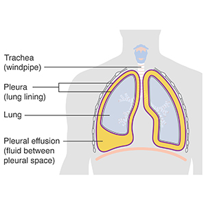 Cancer Research UK / Wikimedia Commons