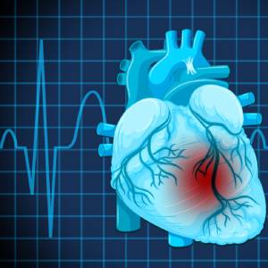 <a href="https://www.vecteezy.com/free-vector/myocardial-infarction">Myocardial Infarction Vectors by Vecteezy</a> 